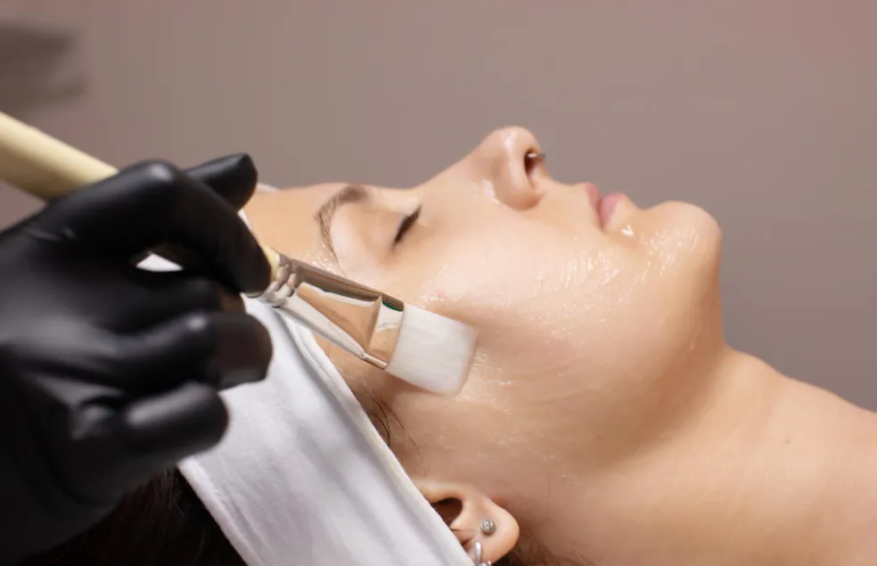 chemický peeling