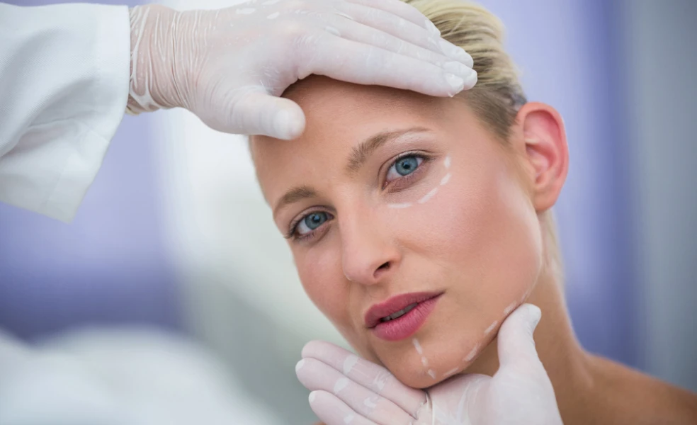 dermálne výplne online Beauty Active