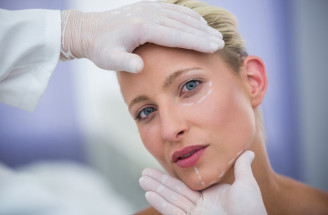 Dobré dermálne výplne online Beauty Active: Kvalita, ktorú je vidieť ihneď po ošetrení