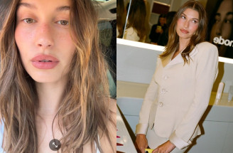 Hailey Bieber a jej nový trik s korektorom: Rozjasnená pleť už za pár sekúnd