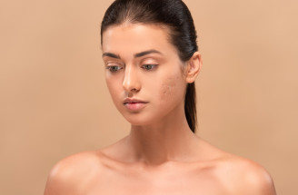 5 virálnych beauty trendov, ktoré vedia pleti viac uškodiť než pomôcť
