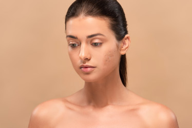 5 virálnych beauty trendov, ktoré vedia pleti viac uškodiť než pomôcť
