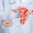 September je mesiacom osvety o PCOS: Prečo milióny žien stále nepoznajú diagnózu?