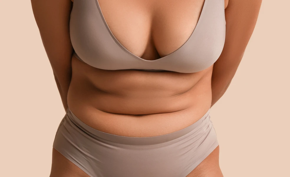 kde sa v tele ukladá tuk