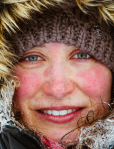 Rosacea liečba v zime: Súboj, ktorý trápi státisíce ľudí so svetlou pleťou