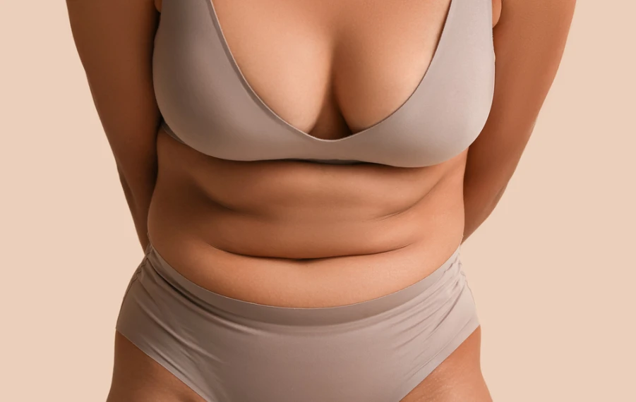 kde sa v tele ukladá tuk