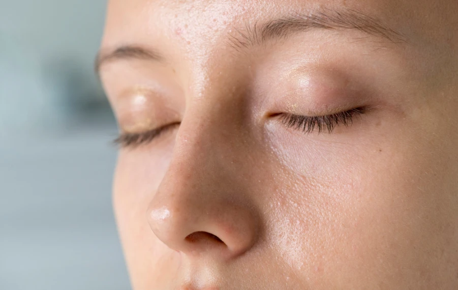 Mastná pleť a moderná skincare rutina v roku 2026