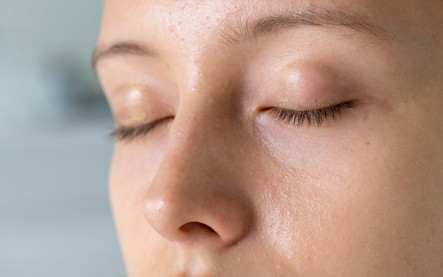Mastná pleť a moderná skincare rutina v roku 2026